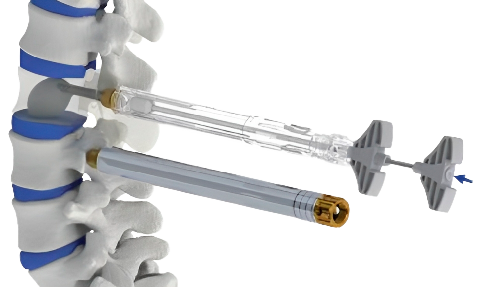 VENUS TORNILLO PARA CEMENTAR